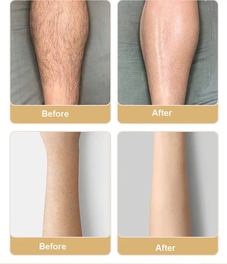 CRYSTAL HAIR REMOVER - Image 2